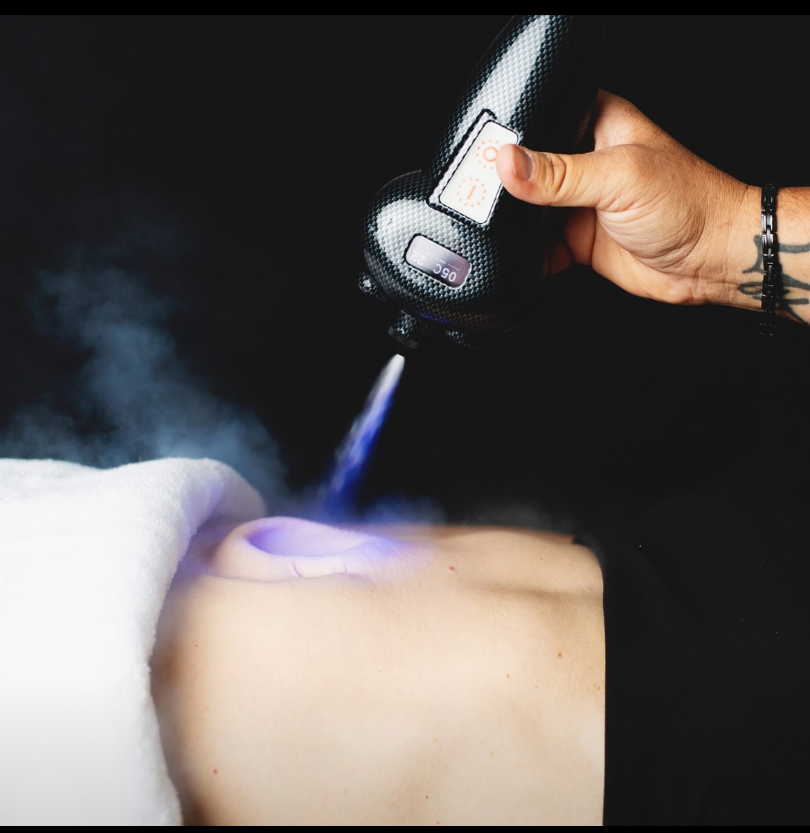 Cryo therapy example